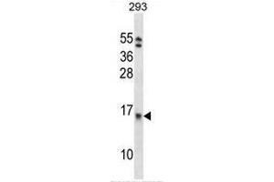 Image no. 1 for anti-Eukaryotic Translation Initiation Factor 1B (EIF1B) (AA 83-113), (C-Term) antibody (ABIN952041)