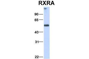 Image no. 3 for anti-Retinoid X Receptor, alpha (RXRA) (N-Term) antibody (ABIN2778244)