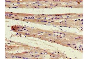 Immunohistochemistry of paraffin-embedded human heart tissue using ABIN7165502 at dilution of 1:100