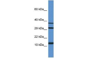 Image no. 1 for anti-Ubiquitin-Like 3 (UBL3) (C-Term) antibody (ABIN2786869)