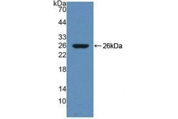 Dynamin 1 antibody  (AA 572-745)