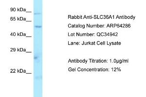 Image no. 1 for anti-Solute Carrier Family 36 (Proton/amino Acid Symporter), Member 1 (SLC36A1) (N-Term) antibody (ABIN2789790)
