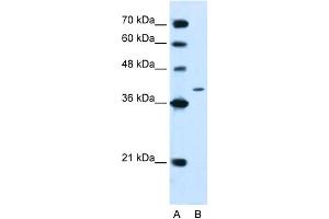 Image no. 1 for anti-Protein tyrosine Phosphatase, Non-Receptor Type 2 (PTPN2) (N-Term) antibody (ABIN2782194)