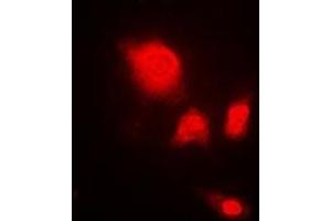 Image no. 1 for anti-Ubiquitin Carboxyl-terminal Hydrolase L5 (UCHL5) antibody (ABIN2967129)