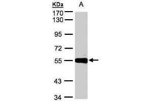 Image no. 1 for anti-Carboxypeptidase M (CPM) (Center) antibody (ABIN2856275)