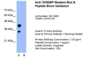Image no. 5 for anti-TAR DNA Binding Protein (TARDBP) (C-Term) antibody (ABIN2780849)