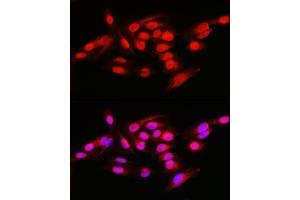 Image no. 1 for anti-Nuclear Factor of kappa Light Polypeptide Gene Enhancer in B-Cells 1 (NFKB1) (AA 740-964) antibody (ABIN6144571)