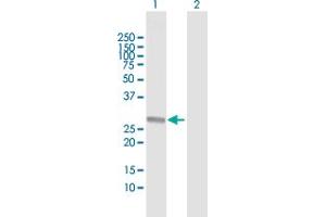 Western Blot analysis of RABL2B expression in transfected 293T cell line by RABL2B MaxPab polyclonal antibody.