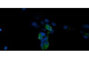 Image no. 6 for anti-Mitogen-Activated Protein Kinase 4 (MAPK4) antibody (ABIN1499312)