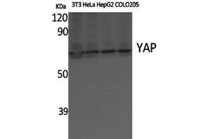 Western Blot analysis of various cells using YAP1 Polyclonal Antibody at dilution of 1:500.