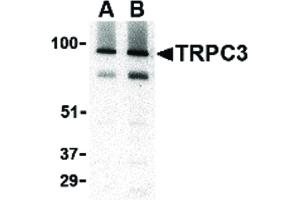 Image no. 1 for anti-Transient Receptor Potential Cation Channel, Subfamily C, Member 3 (TRPC3) (C-Term) antibody (ABIN6655766)