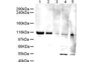 Western blot using  Affinity Purified anti-Elg1 antibody shows detection of a band ~120 kDa corresponding to human Elg1 (arrowhead) in various cell lysates.