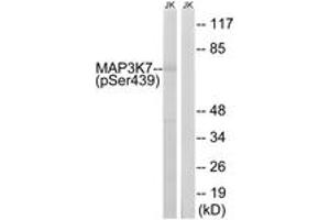 Image no. 1 for anti-Mitogen-Activated Protein Kinase Kinase Kinase 7 (MAP3K7) (AA 411-460), (pSer439) antibody (ABIN1532056)