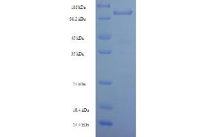 Image no. 1 for Leucine Rich Repeat Neuronal 1 (LRRN1) (AA 26-631) protein (His-SUMO Tag) (ABIN5711441)