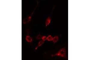 Image no. 2 for anti-Calpain 10 (CAPN10) antibody (ABIN6256983)