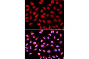 Image no. 3 for anti-Protein Phosphatase 2A Activator, Regulatory Subunit 4 (PPP2R4) antibody (ABIN1682265)