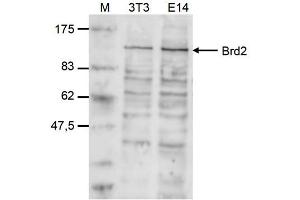 Image no. 2 for anti-Bromodomain Containing 2 (BRD2) (Internal Region) antibody (ABIN6657772)