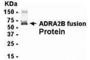 Image no. 1 for anti-Adrenergic, alpha-2B-, Receptor (ADRA2B) (AA 200-299) antibody (ABIN2467937)