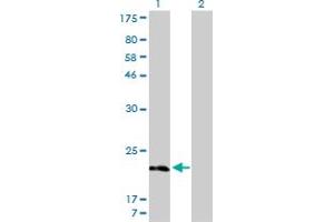 Image no. 2 for anti-Myosin, Light Chain 5, Regulatory (MYL5) (AA 1-132) antibody (ABIN561900)