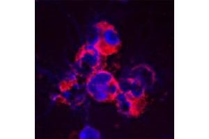 Image no. 3 for anti-Cathelicidin Antimicrobial Peptide (CAMP) antibody (ABIN571374)