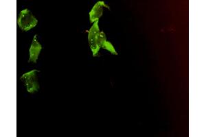 Immunofluorescence of monoclonal antibody to SMN2 on HeLa cell.