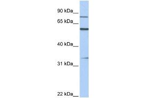 Image no. 1 for anti-Zinc Finger Protein 16 (ZNF16) (C-Term) antibody (ABIN2780819)