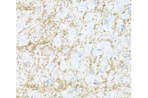 Immunohistochemistry of paraffin-embedded Rat brain using CNP Polyclonal Antibody at dilution of 1:100 (40x lens).