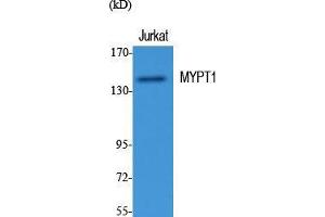 Image no. 2 for anti-Myosin Phosphatase, Target Subunit 1 (PPP1R12A) (Thr103) antibody (ABIN3185745)