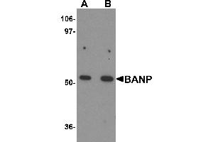 Image no. 2 for anti-Protein BANP (BANP) (Middle Region) antibody (ABIN1030879)