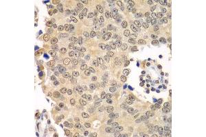 Image no. 12 for anti-Histone Deacetylase 2 (HDAC2) antibody (ABIN3022867)