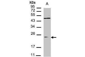 Image no. 1 for anti-Vacuolar Protein Sorting 29 (VPS29) (C-Term) antibody (ABIN2855943)