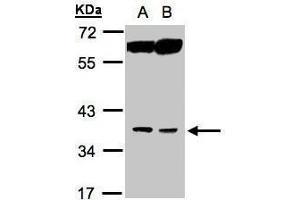 WB Image Sample(30 ug whole cell lysate) A:MOLT4 , B:Raji , 10% SDS PAGE antibody diluted at 1:1000