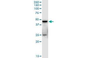 Image no. 2 for anti-SHANK-Associated RH Domain Interacting Protein (SHARPIN) (AA 1-326) antibody (ABIN529413)