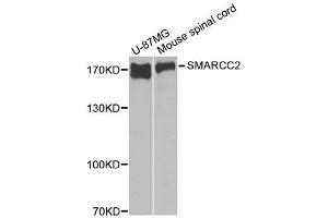 Image no. 2 for anti-SWI/SNF Related, Matrix Associated, Actin Dependent Regulator of Chromatin, Subfamily C, Member 2 (SMARCC2) antibody (ABIN3022693)
