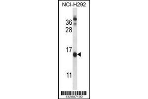 Image no. 1 for anti-Cornichon Homolog (CNIH) (AA 76-104), (C-Term) antibody (ABIN657517)