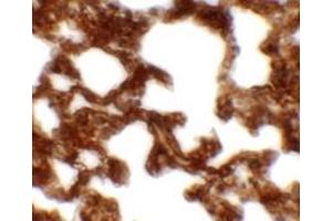 Image no. 1 for anti-Neuropilin (NRP) and Tolloid (TLL)-Like 1 (NETO1) (C-Term) antibody (ABIN1450052)
