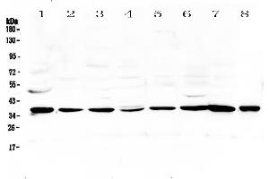 Image no. 1 for anti-Thrombopoietin (THPO) (AA 27-259) antibody (ABIN5692952)
