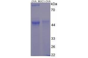 Image no. 3 for Mucin 1 (MUC1) peptide (Ovalbumin) (ABIN5666275)