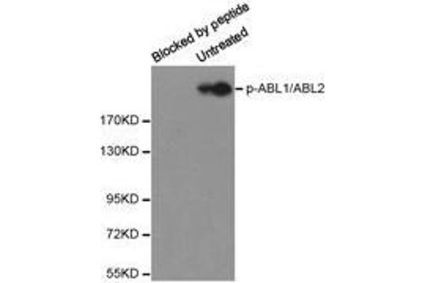anti-Abelson Murine Leukemia Viral Oncogene Homolog 1/2 (ABL1/ABL2) (pTyr393), (pTyr429) antibody