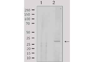 Image no. 4 for anti-Activating Transcription Factor 1 (AFT1) (Internal Region) antibody (ABIN6256913)
