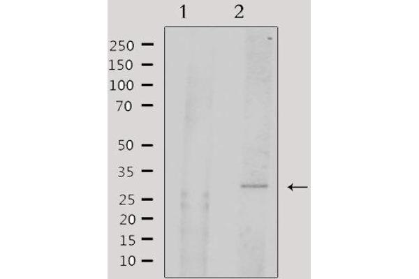AFT1 antibody  (Internal Region)