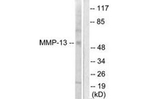 Image no. 3 for anti-Matrix Metallopeptidase 13 (Collagenase 3) (MMP13) (AA 10-59) antibody (ABIN1533345)