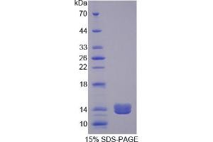Image no. 1 for Procollagen-Lysine 2-Oxoglutarate 5-Dioxygenase 2 (PLOD2) (AA 644-737) protein (His tag) (ABIN6237339)
