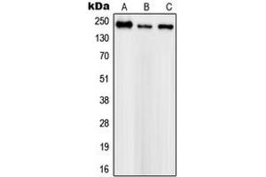 Image no. 2 for anti-Sodium Channel, Voltage-Gated, Type I, alpha Subunit (SCN1A) (Center) antibody (ABIN2706642)
