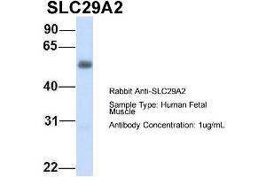 Image no. 4 for anti-Solute Carrier Family 29 (Nucleoside Transporters), Member 2 (SLC29A2) (C-Term) antibody (ABIN2781572)