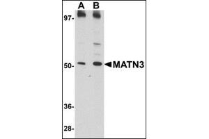 Image no. 2 for anti-Matrilin 3 (MATN3) (C-Term) antibody (ABIN500244)