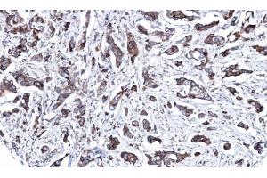Image no. 3 for anti-Mitogen-Activated Protein Kinase Kinase 2 (MAP2K2) (Center) antibody (ABIN2855318)