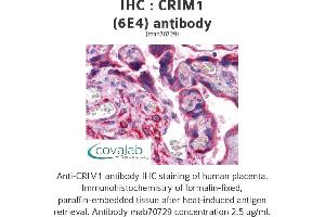 Image no. 1 for anti-Cysteine Rich Transmembrane BMP Regulator 1 (Chordin-Like) (CRIM1) (AA 36-146) antibody (ABIN1723586)