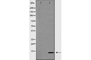 Image no. 1 for anti-Insulin-Like 3 (Leydig Cell) (INSL3) antibody (ABIN6262601)