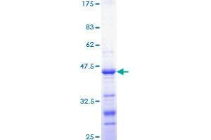 Image no. 1 for Catenin (Cadherin-Associated Protein), beta 1, 88kDa (CTNNB1) (AA 682-781) protein (GST tag) (ABIN1350672)